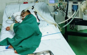 Bị ong vò vẽ đốt hơn 80 mũi, bé trai 4 tuổi phải lọc máu cấp cứu