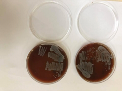 Phòng tránh Whitmore - căn bệnh bị đồn là 'vi khuẩn ăn thịt người' thế nào?