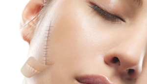 Những biến chứng nguy hiểm khi phẫu thuật thẩm mỹ