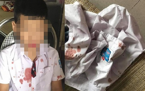 Phụ huynh đánh chảy máu bé trai lớp 1, cộng đồng mạng giận run đòi xử lý