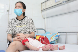 Số trẻ mắc tay chân miệng tăng gấp 5-6 lần: Chuyên gia chỉ rõ dấu hiệu bệnh