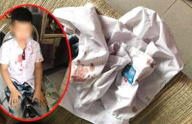 Mâu thuẫn được giải quyết nhưng bố vẫn ra tay tàn bạo với bạn học lớp 1 của con