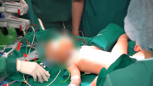 Video: Bên trong phòng phẫu thuật tách rời 2 bé song sinh dính liền