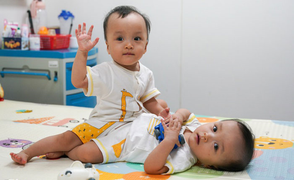 'Quyết định tách hai bé gái song sinh dính liền táo bạo nhưng nhân văn'