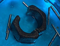 Nhập viện vì tự nhét 'cậu nhỏ' vào chiếc đai ốc lục giác