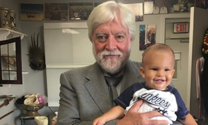 Những bác sĩ dám 'cãi' tạo hóa, dành cả đời để tách rời cặp song sinh dính liền