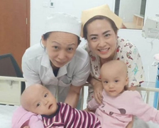 Nữ điều dưỡng kể những lần thót tim khi chăm sóc hai bé sơ sinh dính liền 