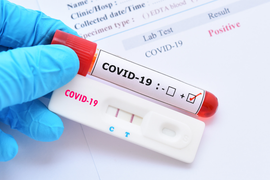Thêm 1 trường hợp mắc COVID-19, Việt Nam có 413 người nhiễm virus corona