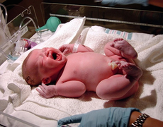 Vì sao lúc cắt dây rốn, bé khóc to còn mẹ không thấy đau?