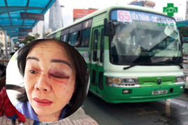 Mở nhạc to bị nhắc, gã đàn ông lao vào hành hung tím mặt nữ tiếp viên xe buýt 