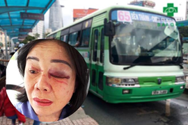 Công an điều tra vụ nữ tiếp viên xe buýt bị hành khách đánh bầm mắt