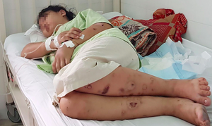 Truy tố nhóm người tra tấn cô gái tới sảy thai