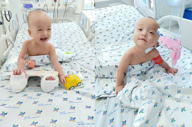 Trúc Nhi - Diệu Nhi ngồi dậy chơi đùa, cười tít mắt sau một tháng mổ tách