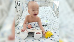 Dự kiến 5 tuần tới tháo bột hoàn toàn cho 2 bé Trúc Nhi - Diệu Nhi