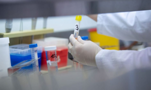 Hơn 50 công an phường tiếp xúc bệnh nhân COVID-19 người Trung Quốc đều âm tính 