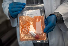 Thụy Sĩ phát hiện virus SARS-CoV-2 trong da người