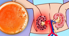 7 thực phẩm gây hại thận, bạn không nên ăn nhiều