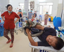 Người đàn ông bị rắn hổ mang chúa cắn đang nguy kịch, phải lọc máu liên tục