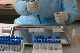 Một người Hà Nội test nhanh dương tính virus corona khi đến Nhật Bản