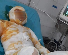 Khởi tố kẻ tưới xăng đốt vợ ở Thái Bình