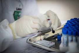 Nam thanh niên ở Hà Nội dương tính với SARS-CoV-2