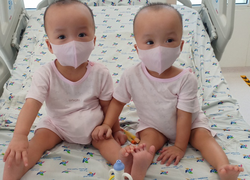 Trúc Nhi và Diệu Nhi chuẩn bị tập đi sau 45 ngày mổ tách 