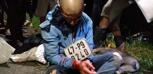 Trộm chó giữa đêm, 'cẩu tặc' bị dân đánh nhập viện