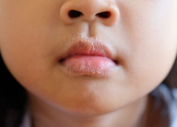 Những thay đổi bất thường trên cơ thể cảnh báo bệnh nguy hiểm