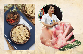 Chấm dứt bệnh ngoài da với bài thuốc của Trung tâm Da liễu Đông y Việt Nam
