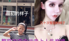 Fan hết hồn khi biết hot girl mạng xã hội 'sửa nát mặt' từ năm 13 tuổi