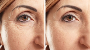 Bỏ ngay những thói quen này nếu không muốn nếp nhăn hình thành sớm