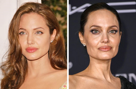 8 dấu hiệu trên mặt tiết lộ tuổi thật của phụ nữ