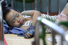 Ảnh: Bệnh chân tay miệng gia tăng nhanh ở TP.HCM