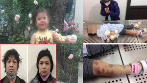 Bé gái 3 tuổi bị cha dượng, mẹ đẻ bạo hành đến chết: Một ngày 6 trận đòn roi