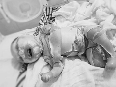 Hội chẩn trực tuyến, tìm phương án điều trị tốt nhất cho bé sơ sinh da vảy cá