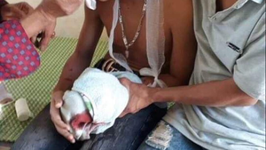 Laptop phát nổ, 3 học sinh ở Hà Tĩnh bị thương