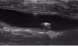 Robot siêu nhỏ di chuyển tinh vi trong ruột động vật