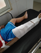 Đình chỉ công tác cô giáo làm gãy chân bé 4 tuổi ở Đồng Nai 