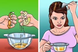 9 cách trị gàu cực tốt mà không cần dùng hóa chất