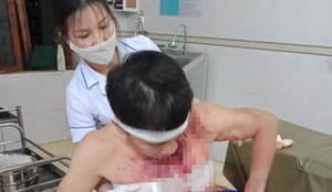 4 kẻ lạ mặt xông vào tấn công chủ nhà trọng thương 