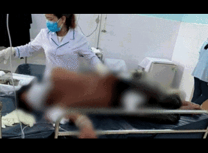 Sức khỏe người đàn ông ở Quảng Nam bị gấu rừng tấn công hiện ra sao?