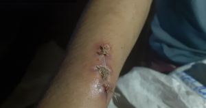 Tạm giữ khẩn cấp nữ chủ quán bánh xèo tra tấn nhân viên ở Bắc Ninh