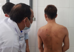 Bị chủ quán bánh xèo tra tấn dã man, vì sao nhân viên không bỏ trốn?