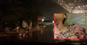 Khởi tố vụ án nổ súng khiến nam thanh niên trọng thương ở Thái Bình