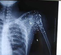 Khởi tố kẻ nã súng như phim 'xã hội đen' ở Thái Bình