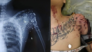 Kẻ nã súng như phim 'xã hội đen' vào nam thanh niên ở Thái Bình ra đầu thú