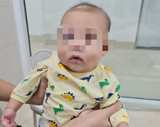 Bé trai 6 tháng tuổi ở Phú Thọ mắc bệnh siêu hiếm, chưa từng gặp tại Việt Nam