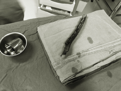 Cứu người đàn ông bị cây gỗ đâm xuyên mặt