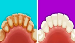 6 mẹo hay giúp loại bỏ mảng bám để có hàm răng trắng muốt 