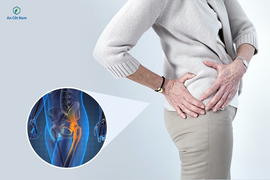 Bác sĩ Nguyễn Bá Vưỡng chia sẻ về chứng đau từ thắt lưng xuống mông